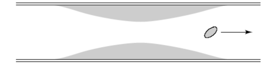 A platelet moving from the narrow blocked region of an artery into the wider region